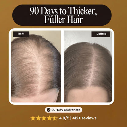 Promotional graphic for a hair growth or thickening product, showing a side-by-side comparison of a man's scalp with thinning hair labeled 'DAY 1' and fuller hair labeled 'MONTH 3'. Large text at the top reads '90 Days to Thicker, Fuller Hair' on a brown background with a 90-day guarantee badge and review stars at the bottom.